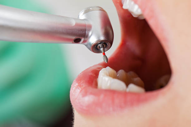 Best Root Canal Emergency Dentist  in Tipton, IN